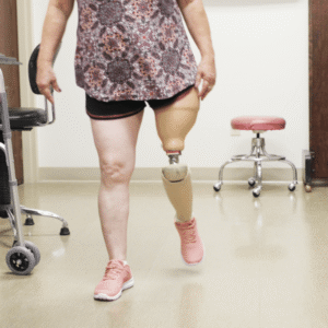 above knee artificial leg