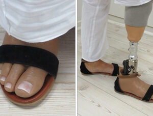 artificial leg below knee
