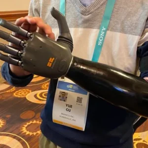 ai prosthetic hand